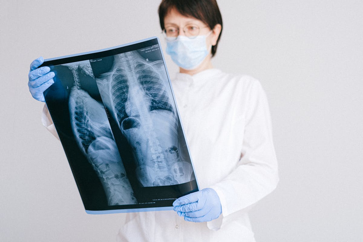 Biopsia hepatică: când este necesară și ce riscuri implică