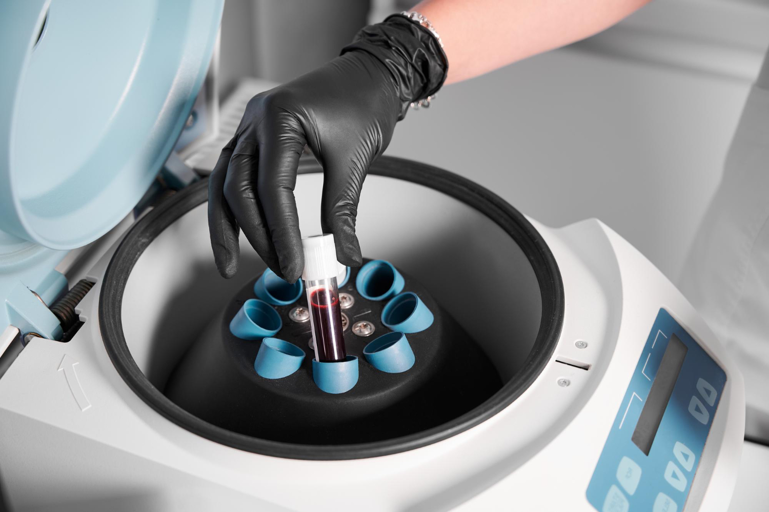 Biopsia prostatei: diferențe intre metode