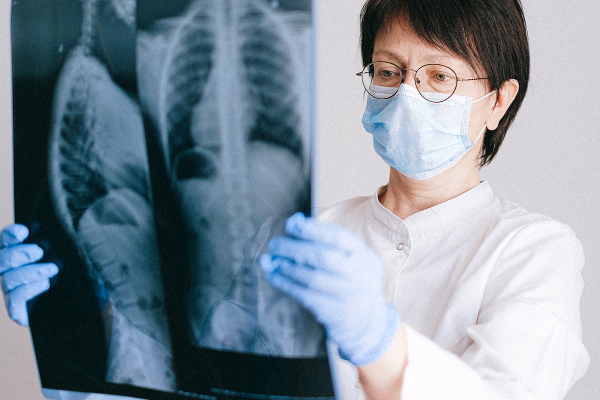 Biopsia pulmonară ghidată CT: riscuri, beneficii și pași