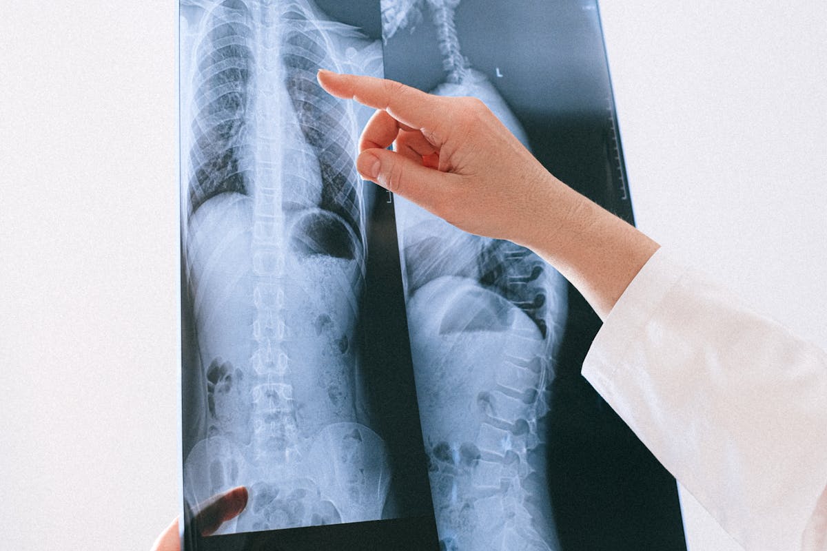 CT coloană vs RMN coloană – avantaje și limitări
