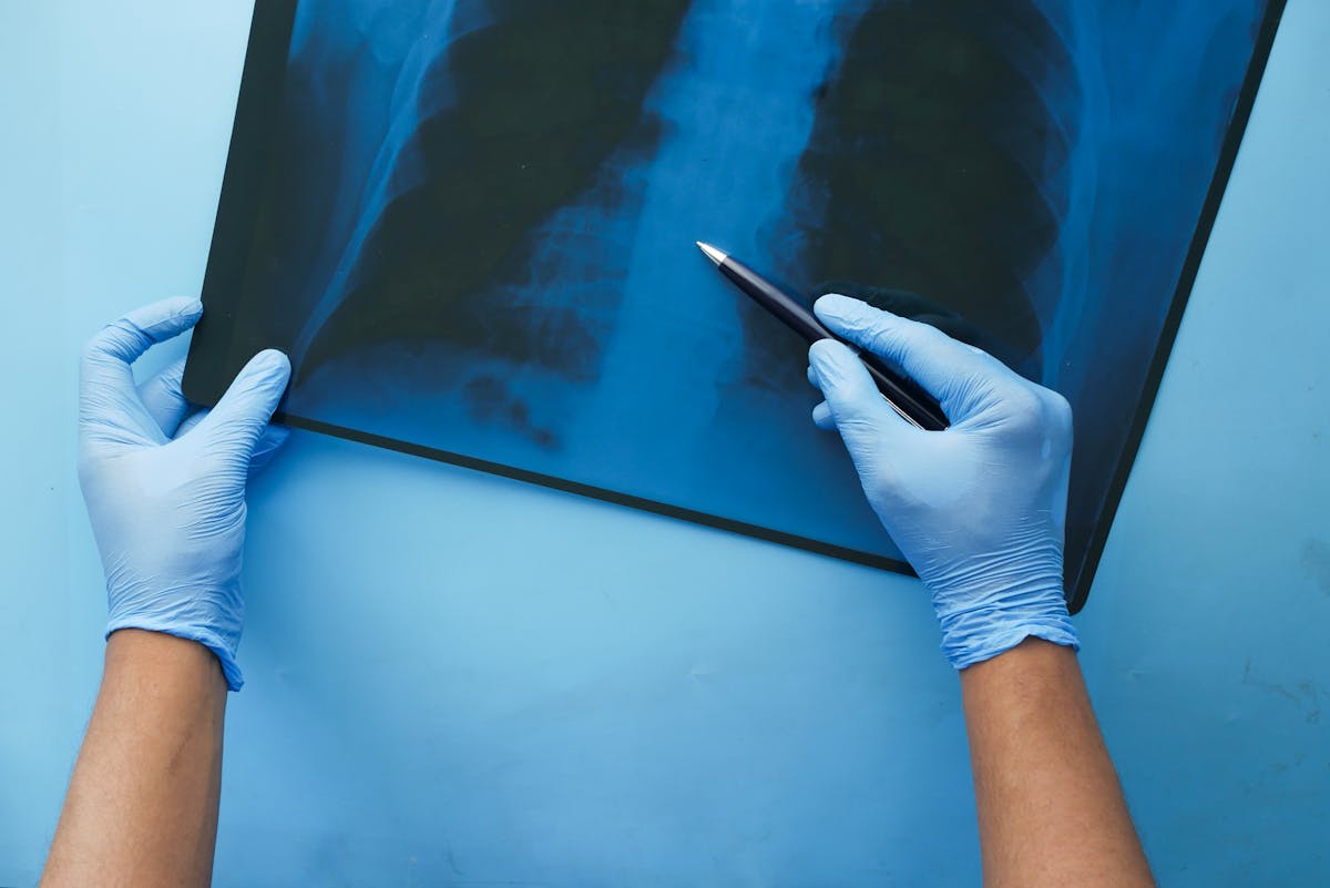 CT toracic vs RMN toracic – când și de ce se recomandă fiecare