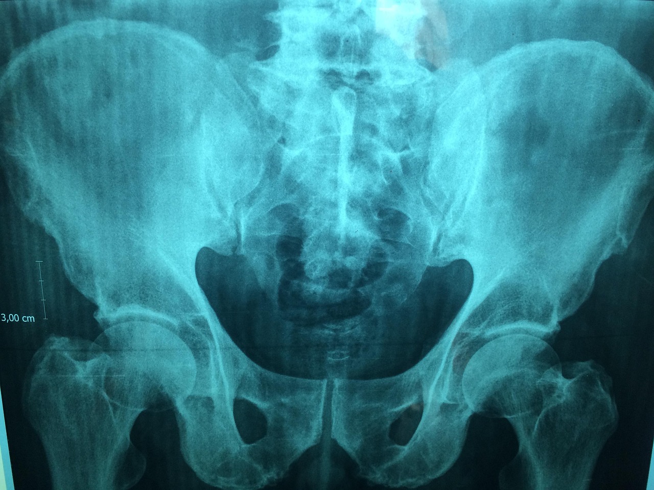 Imagistica pelvină la femei: ce poate releva un RMN de pelvis