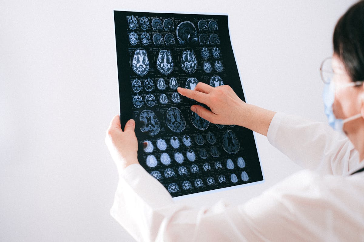 RMN cerebral funcțional: când se folosește și ce detectează