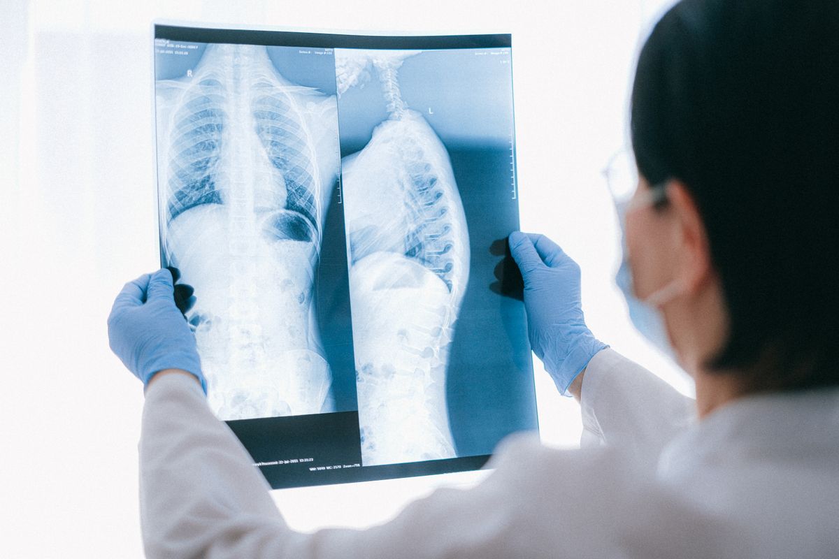 Nodul pulmonar suspect la CT: când poate fi utilă reevaluarea imaginilor